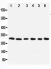 NOL3 / ARC Antibody - WB of NOL3 / ARC antibody. All lanes: Anti-NOL3 at 0.5ug/ml. Lane 1: SMMC Whole Cell Lysate at 40ug. Lane 2: A549 Whole Cell Lysate at 40ug. Lane 3: U87 Whole Cell Lysate at 40ug. Lane 4: HELA Whole Cell Lysate at 40ug. Lane 5: MCF-7 Whole Cell Lysate at 40ug. Lane 6: Rat Liver Tissue Lysate at 40ug. Predicted bind size: 24KD. Observed bind size: 24KD.