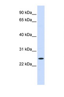 NOL3 / ARC Antibody - NOL3 antibody Western blot of Fetal Muscle lysate. Antibody concentration 1 ug/ml. This image was taken for the unconjugated form of this product. Other forms have not been tested.