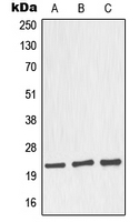 NOL3 / ARC Antibody - Western blot analysis of Nop30 expression in MCF7 (A); HeLa (B); mouse brain (C); rat brain (D) whole cell lysates.