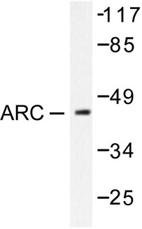 NOL3 / ARC Antibody - Western blot of ARC (E194) pAb in extracts from HeLa cells.