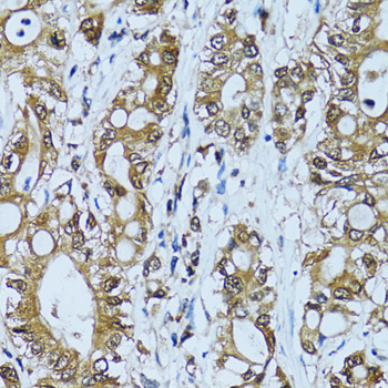 NOL3 / ARC Antibody - Immunohistochemistry of paraffin-embedded human colon carcinoma tissue.