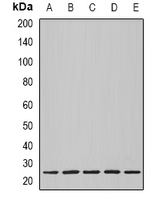NOL3 / ARC Antibody - Western blot analysis of Nop30 expression in BT474 (A); MCF7 (B); mouse heart (C); mouse lung (D); rat heart (E) whole cell lysates.
