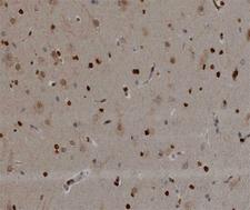 NOL3 / ARC Antibody - 1:200 staining human brain tissue by IHC-P. The tissue was formaldehyde fixed and a heat mediated antigen retrieval step in citrate buffer was performed. The tissue was then blocked and incubated with the antibody for 1.5 hours at 22°C. An HRP conjugated goat anti-rabbit antibody was used as the secondary.
