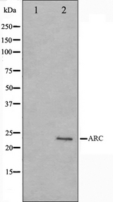 NOL3 / ARC Antibody - Western blot analysis on HeLa cell lysates using ARC antibody. The lane on the left is treated with the antigen-specific peptide.