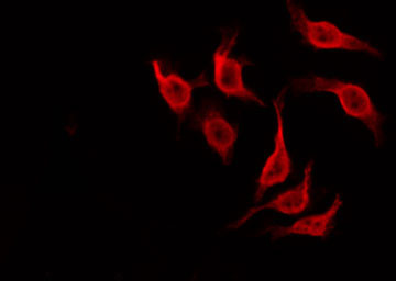 NOL3 / ARC Antibody - Staining HeLa cells by IF/ICC. The samples were fixed with PFA and permeabilized in 0.1% Triton X-100, then blocked in 10% serum for 45 min at 25°C. The primary antibody was diluted at 1:200 and incubated with the sample for 1 hour at 37°C. An Alexa Fluor 594 conjugated goat anti-rabbit IgG (H+L) Ab, diluted at 1/600, was used as the secondary antibody.