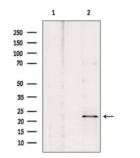 NOL3 / ARC Antibody - Western blot analysis of extracts of HepG2 cells using ARC antibody. Lane 1 was treated with the blocking peptide.