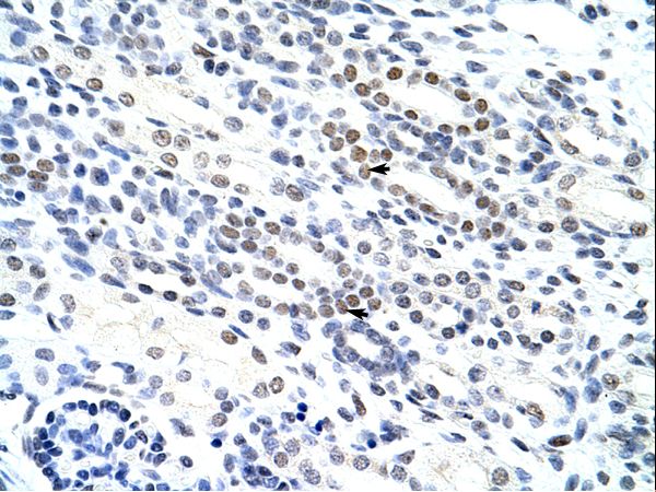 NOL4 Antibody - NOL4 antibody ARP40492_P050-AAH00313-NOL4 (nucleolar protein 4) Antibody was used in IHC to stain formalin-fixed, paraffin-embedded human kidney.  This image was taken for the unconjugated form of this product. Other forms have not been tested.