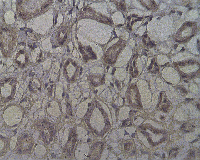 NOL4 Antibody - Staining on paraffin embedded normal human kidney sections using NOL4 antibody at 10 ug/ml. Antigen retrieval used: 10 mM Na Citrate pH 6.0, 10 minutes pressure cooker method., developed with anti rabbit HRP and DAP substrate. Counterstained with methyl blue. 