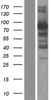 NOL4 Protein - Western validation with an anti-DDK antibody * L: Control HEK293 lysate R: Over-expression lysate