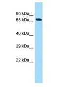 NOL4L Antibody - C20orf112 antibody Western Blot of Fetal Liver. Antibody dilution: 1 ug/ml.  This image was taken for the unconjugated form of this product. Other forms have not been tested.