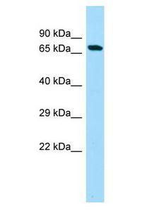 NOL4L Antibody - C20orf112 antibody Western Blot of Fetal Liver. Antibody dilution: 1 ug/ml.  This image was taken for the unconjugated form of this product. Other forms have not been tested.