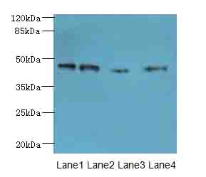 NOL4L Antibody - Western blot. All lanes: NOL4L antibody at 0.3 ug/ml. Lane 1: PC-3 whole cell lysate. Lane 2: A549 whole cell lysate. Lane 3: HepG-2 whole cell lysate. Lane 4: K562 whole cell lysate. Secondary Goat polyclonal to Rabbit IgG at 1:10000 dilution. Predicted band size: 47 kDa. Observed band size: 47 kDa.