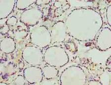 NOL4L Antibody - Immunohistochemistry of paraffin-embedded human thyroid tissue using antibody at dilution of 1:100.