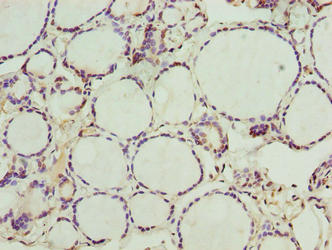 NOL4L Antibody - Immunohistochemistry of paraffin-embedded human thyroid tissue using NOL4L Antibody at dilution of 1:100