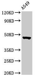 NOL4L Antibody - Western Blot Positive WB detected in: A549 whole cell lysate All lanes: NOL4L antibody at 3µg/ml Secondary Goat polyclonal to rabbit IgG at 1/50000 dilution Predicted band size: 48, 44 kDa Observed band size: 48 kDa