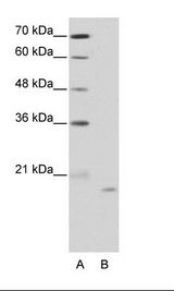 NOL6 / NRAP Antibody - A: Marker, B: HepG2 Cell Lysate.  This image was taken for the unconjugated form of this product. Other forms have not been tested.