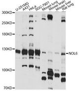 NOL6 / NRAP Antibody - Western blot analysis of extracts of various cell lines, using NOL6 antibody at 1:1000 dilution. The secondary antibody used was an HRP Goat Anti-Rabbit IgG (H+L) at 1:10000 dilution. Lysates were loaded 25ug per lane and 3% nonfat dry milk in TBST was used for blocking. An ECL Kit was used for detection and the exposure time was 15s.
