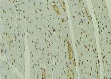 NOL7 / RARG-1 Antibody - 1:100 staining mouse muscle tissue by IHC-P. The sample was formaldehyde fixed and a heat mediated antigen retrieval step in citrate buffer was performed. The sample was then blocked and incubated with the antibody for 1.5 hours at 22°C. An HRP conjugated goat anti-rabbit antibody was used as the secondary.