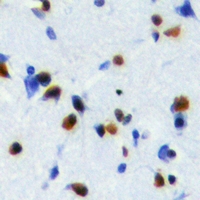 NOL8 Antibody - Immunohistochemical analysis of NOL8 staining in human brain formalin fixed paraffin embedded tissue section. The section was pre-treated using heat mediated antigen retrieval with sodium citrate buffer (pH 6.0). The section was then incubated with the antibody at room temperature and detected using an HRP polymer system. DAB was used as the chromogen. The section was then counterstained with hematoxylin and mounted with DPX.
