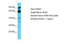 NOL9 Antibody -  This image was taken for the unconjugated form of this product. Other forms have not been tested.