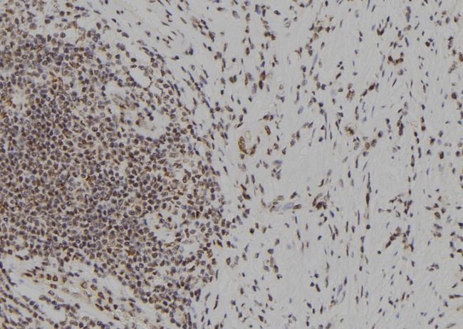 NOL9 Antibody - 1:100 staining human gastric tissue by IHC-P. The sample was formaldehyde fixed and a heat mediated antigen retrieval step in citrate buffer was performed. The sample was then blocked and incubated with the antibody for 1.5 hours at 22°C. An HRP conjugated goat anti-rabbit antibody was used as the secondary.