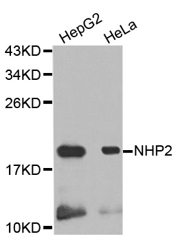 NOLA2 Antibody - Western blot analysis of extracts of various cell lines, using NHP2 antibody.