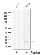NOLA2 Antibody - Western blot analysis of extracts of A375 cells using NHP2 antibody. The lane on the left was treated with blocking peptide.