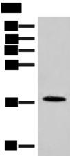 NOLA2 Antibody - Western blot analysis of Human spleen tissue lysate  using NHP2 Polyclonal Antibody at dilution of 1:400