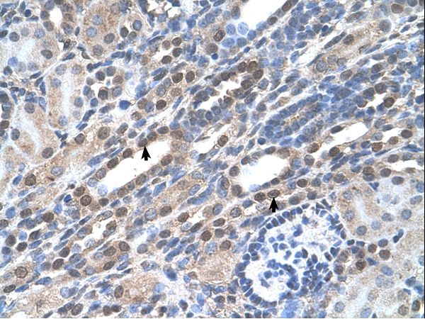 NOLC1 Antibody - NOLC1 antibody NOLC1(nucleolar and coiled-body phosphoprotein 1) Antibody was used in IHC to stain formalin-fixed, paraffin-embedded human kidney.  This image was taken for the unconjugated form of this product. Other forms have not been tested.