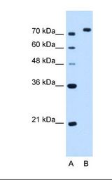 NOLC1 Antibody - Lane A: Marker. Lane B: HepG2 cell lysate. Antibody concentration: 2.5 ug/ml. Gel concentration: 12%.  This image was taken for the unconjugated form of this product. Other forms have not been tested.