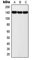 NOLC1 Antibody - Western blot analysis of NOLC1 expression in MCF7 (A); SP2/0 (B); PC12 (C) whole cell lysates.