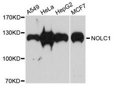 NOLC1 Antibody - Western blot analysis of extracts of various cells.