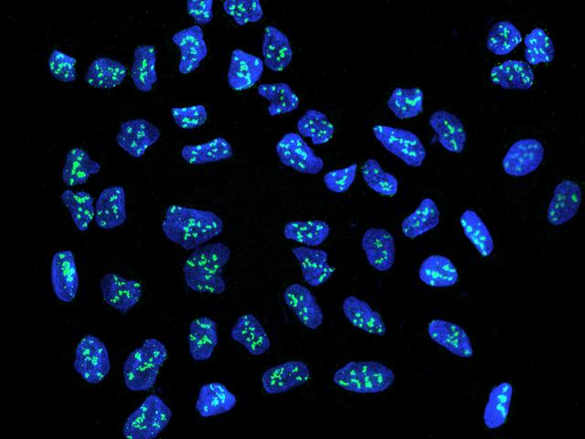 NOLC1 Antibody - Immunofluorescence staining of NOLC1 in U2OS cells. Cells were fixed with 4% PFA, permeabilzed with 0.3% Triton X-100 in PBS, blocked with 10% serum, and incubated with rabbit anti-Human NOLC1 polyclonal antibody (dilution ratio 1:200) at 4°C overnight. Then cells were stained with the Alexa Fluor 488-conjugated Goat Anti-rabbit IgG secondary antibody (green) and counterstained with DAPI (blue). Positive staining was localized to Nucleus.