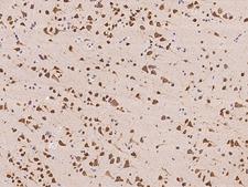 NOLC1 Antibody - Immunochemical staining of human NOLC1 in human brain with rabbit polyclonal antibody at 1:100 dilution, formalin-fixed paraffin embedded sections.