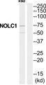 NOLC1 Antibody - Western blot analysis of extracts from K562 cells, using NOLC1 antibody.