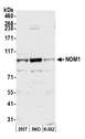 NOM1 Antibody - Detection of human NOM1 by western blot. Samples: Whole cell lysate (50 µg) from HEK293T, RKO, and K-562 cells prepared using NETN lysis buffer. Antibody: Affinity purified rabbit anti-NOM1 antibody used for WB at 1:1000. Detection: Chemiluminescence with an exposure time of 30 seconds.
