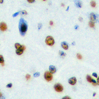 NOM1 Antibody - Immunohistochemical analysis of NOM1 staining in human brain formalin fixed paraffin embedded tissue section. The section was pre-treated using heat mediated antigen retrieval with sodium citrate buffer (pH 6.0). The section was then incubated with the antibody at room temperature and detected using an HRP conjugated compact polymer system. DAB was used as the chromogen. The section was then counterstained with hematoxylin and mounted with DPX.