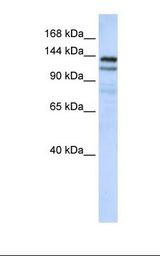NOMO1 / PM5 Antibody - MCF7 cell lysate. Antibody concentration: 1.0 ug/ml. Gel concentration: 6-18%.  This image was taken for the unconjugated form of this product. Other forms have not been tested.