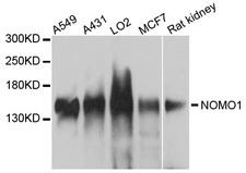 NOMO1 / PM5 Antibody - Western blot analysis of extracts of various cells.