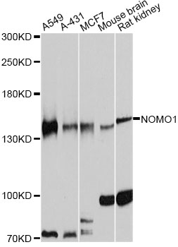 NOMO1 / PM5 Antibody - Western blot analysis of extracts of various cell lines, using NOMO1 antibody at 1:7000 dilution. The secondary antibody used was an HRP Goat Anti-Rabbit IgG (H+L) at 1:10000 dilution. Lysates were loaded 25ug per lane and 3% nonfat dry milk in TBST was used for blocking. An ECL Kit was used for detection and the exposure time was 60s.