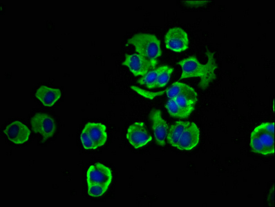 NOMO1 / PM5 Antibody - Immunofluorescence staining of MCF-7 cells at a dilution of 1:33, counter-stained with DAPI. The cells were fixed in 4% formaldehyde, permeabilized using 0.2% Triton X-100 and blocked in 10% normal Goat Serum. The cells were then incubated with the antibody overnight at 4°C.The secondary antibody was Alexa Fluor 488-congugated AffiniPure Goat Anti-Rabbit IgG (H+L) .