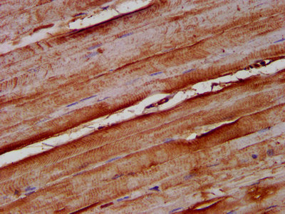 NOMO1 / PM5 Antibody - Immunohistochemistry image at a dilution of 1:100 and staining in paraffin-embedded human skeletal muscle tissue performed on a Leica BondTM system. After dewaxing and hydration, antigen retrieval was mediated by high pressure in a citrate buffer (pH 6.0) . Section was blocked with 10% normal goat serum 30min at RT. Then primary antibody (1% BSA) was incubated at 4 °C overnight. The primary is detected by a biotinylated secondary antibody and visualized using an HRP conjugated SP system.