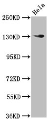 NOMO1 / PM5 Antibody - Positive Western Blot detected in Hela whole cell lysate. All lanes: NOMO1 antibody at 3 µg/ml Secondary Goat polyclonal to rabbit IgG at 1/50000 dilution. Predicted band size: 135 KDa. Observed band size: 135 KDa