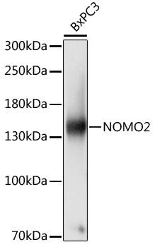 NOMO1 / PM5 Antibody - Western blot analysis of extracts of BxPC3 cells using NOMO2 Polyclonal Antibody at dilution of 1:1000.