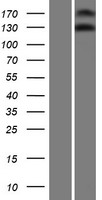 NOMO3 Protein - Western validation with an anti-DDK antibody * L: Control HEK293 lysate R: Over-expression lysate