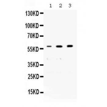 NONO / P54NRB Antibody - Western blot analysis of nmt55/p54nrb expression in rat brain extract (lane 1), human placenta extract (lane 2) and PANC whole cell lysates (lane 3). nmt55/p54nrb at 60 kD was detected using rabbit anti-FBXL4 Antigen Affinity purified polyclonal antibody at 0.5 ug/mL. The blot was developed using chemiluminescence (ECL) method.