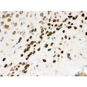 NONO / P54NRB Antibody - nmt55/p54nrb was detected in paraffin-embedded sections of mouse brain tissues using rabbit anti- nmt55/p54nrb Antigen Affinity purified polyclonal antibody at 1 ug/mL. The immunohistochemical section was developed using SABC method.