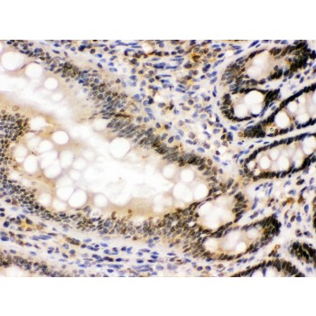 NONO / P54NRB Antibody - nmt55/p54nrb was detected in paraffin-embedded sections of rat intestine tissues using rabbit anti- nmt55/p54nrb Antigen Affinity purified polyclonal antibody at 1 ug/mL. The immunohistochemical section was developed using SABC method.