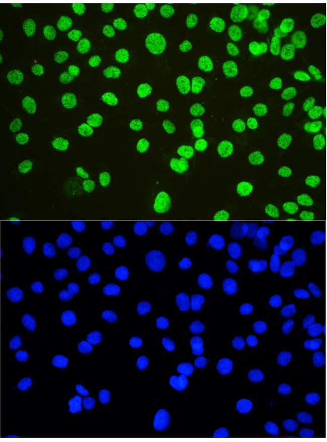 NONO / P54NRB Antibody - IF analysis of nmt55/p54nrb using anti-nmt55/p54nrb antibody nmt55/p54nrb was detected in immunocytochemical section of SKOV-3 cells. Enzyme antigen retrieval was performed using IHC enzyme antigen retrieval reagent for 15 mins. The tissue section was blocked with 10% goat serum. The tissue section was then incubated with 2µg/mL rabbit anti-nmt55/p54nrb Antibody overnight at 4°C. DyLight®488 Conjugated Goat Anti-Rabbit IgG was used as secondary antibody at 1:100 dilution and incubated for 30 minutes at 37°C. The section was counterstained with DAPI. Visualize using a fluorescence microscope and filter sets appropriate for the label used.