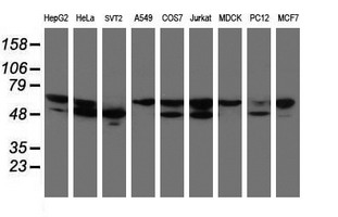 NONO / P54NRB Antibody - Western blot of extracts (35 ug) from 9 different cell lines by using anti-NONO monoclonal antibody (HepG2: human; HeLa: human; SVT2: mouse; A549: human; COS7: monkey; Jurkat: human; MDCK: canine; PC12: rat; MCF7: human).